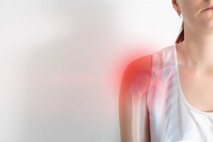 Olkapää punoittaa.